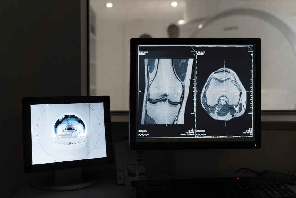 precio-de-estudio-de-tomografia-con-traumatologo-en-cdmx.jpg